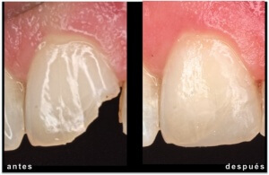 CENTRAL-NATALIA-300x195