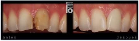 Central-Zirconio-450x132