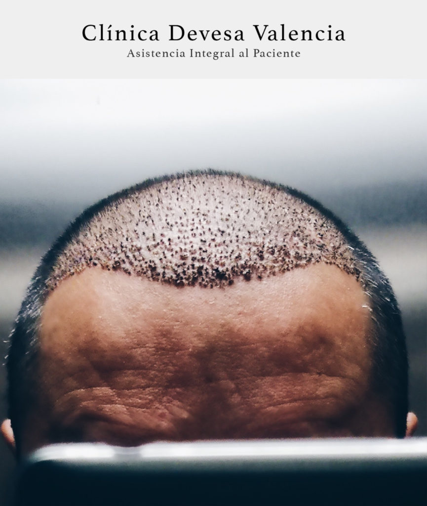 Clinica Devesa