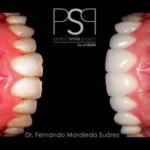 Clínica Dental Smilelife - Chamartin