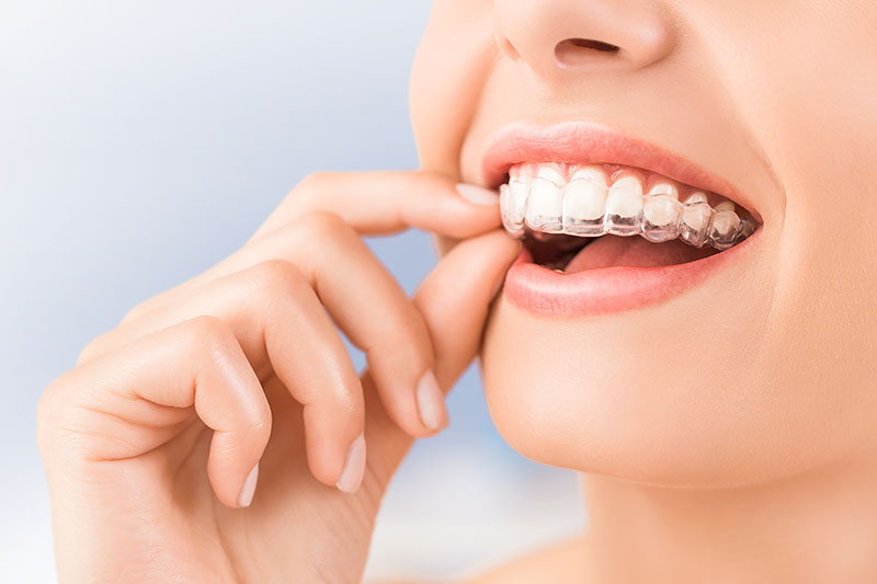 clinica_dental_el_pilar_tratamiento_ortodoncia3_smll