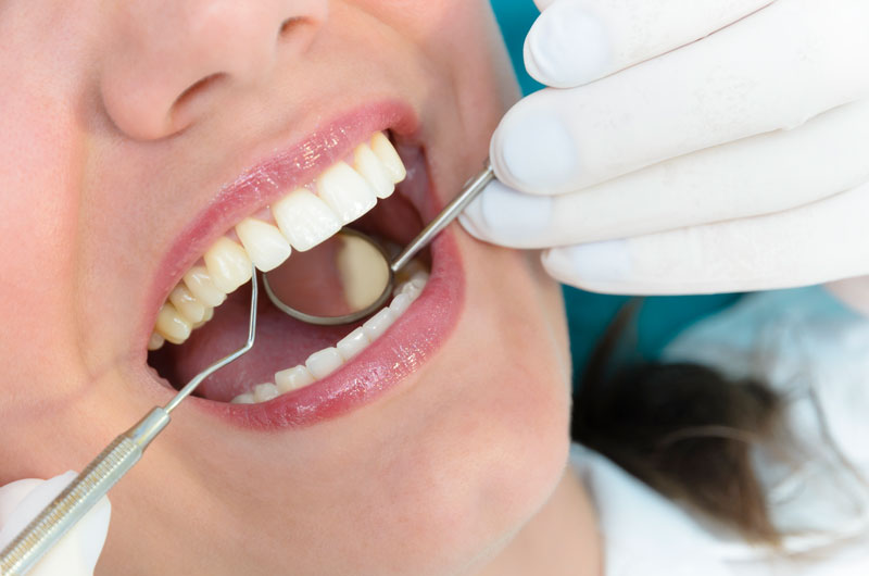 clinica_dental_el_pilar_tratamiento_periodoncia_smll