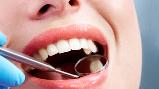 endodoncia-dentista-madrid