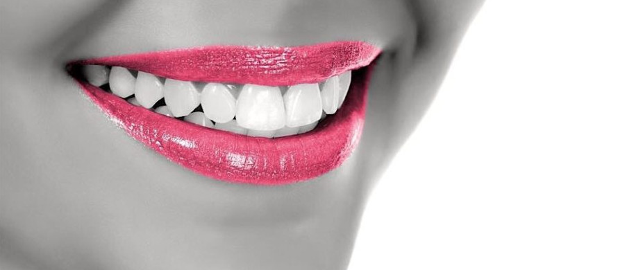 estetica-dental