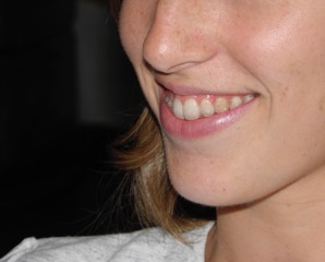 foto-invisa01