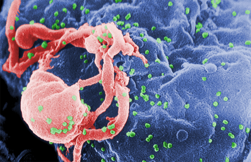 Nueva terapia de anticuerpos ataca el 99% de las cepas de VIH