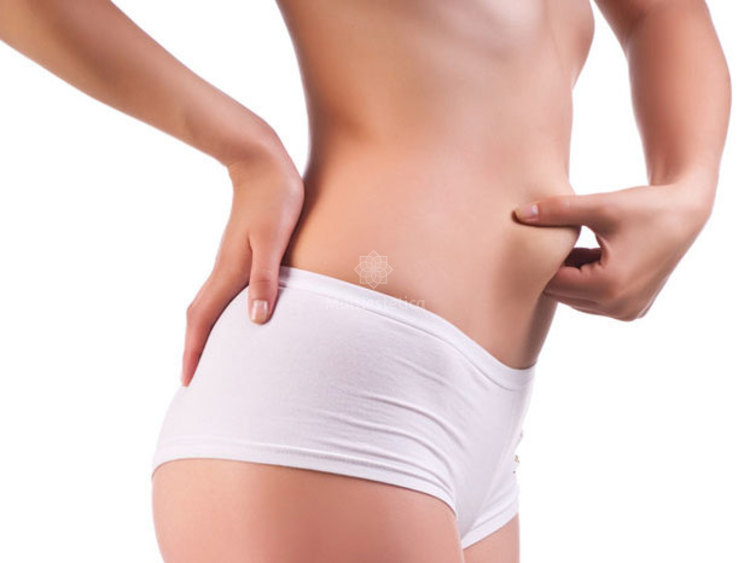 lipoescultura_ci3