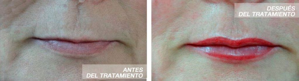 micropigmentacion-labios-finas-madrid