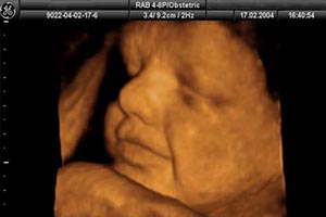 pack_obstetricia