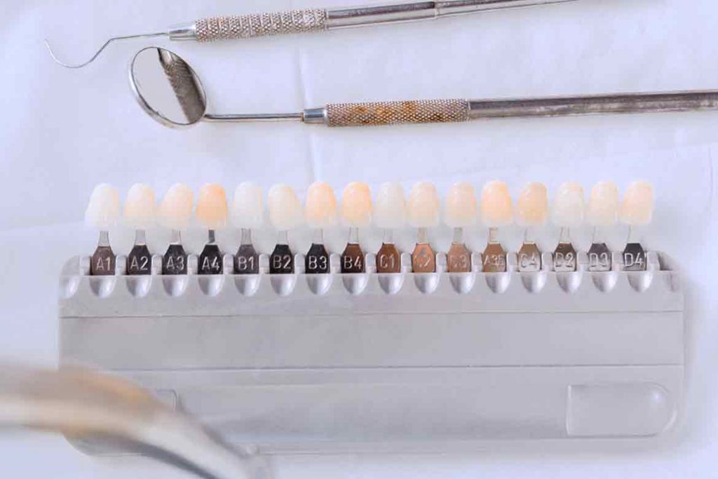 tonos-blanqueamientos-dentales-1024&#215;683