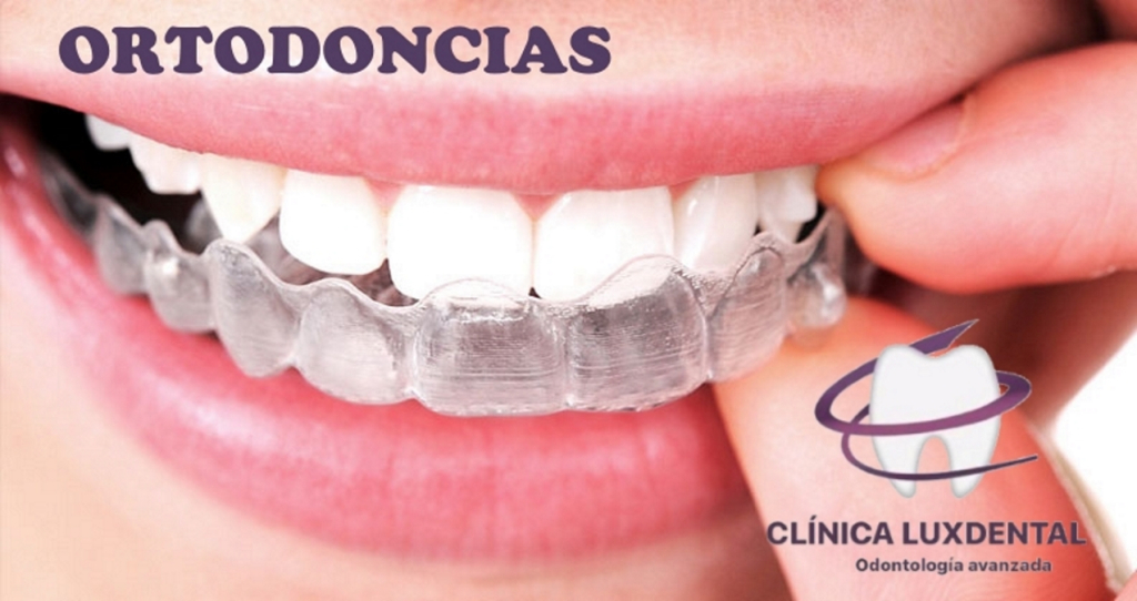 lux-dental-malvarrosa-luxdentalmalvarrosa-ortodoncias-1