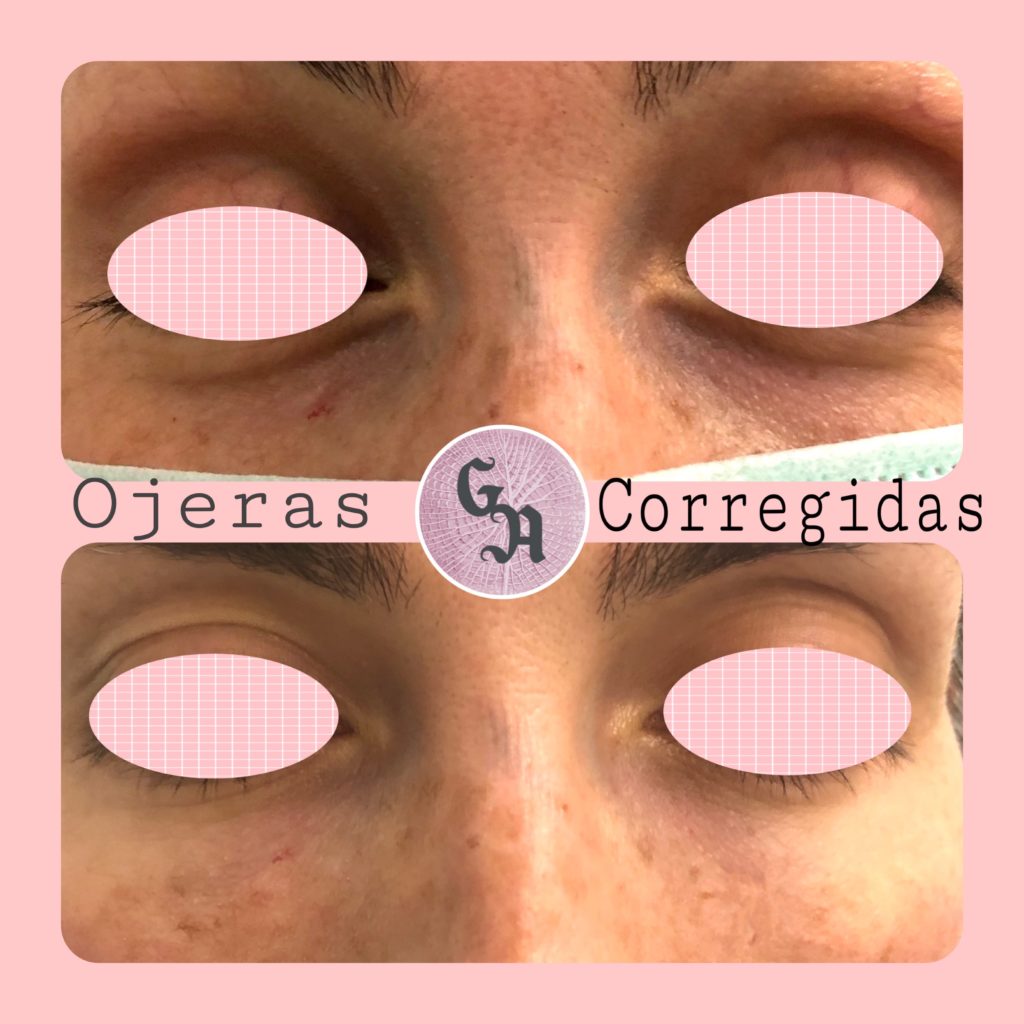 95BB80CF-FEC6-40DE-8A92-F3984F66E57F