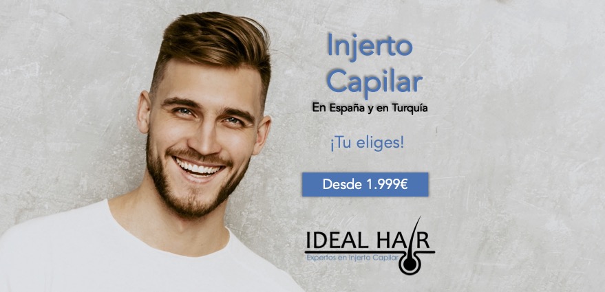 Ideal Hair – Injerto Capilar