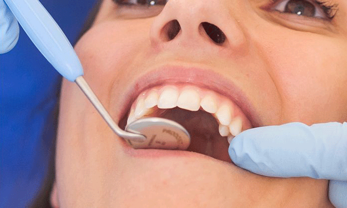 odontologia-minimamente-invasiva-omi