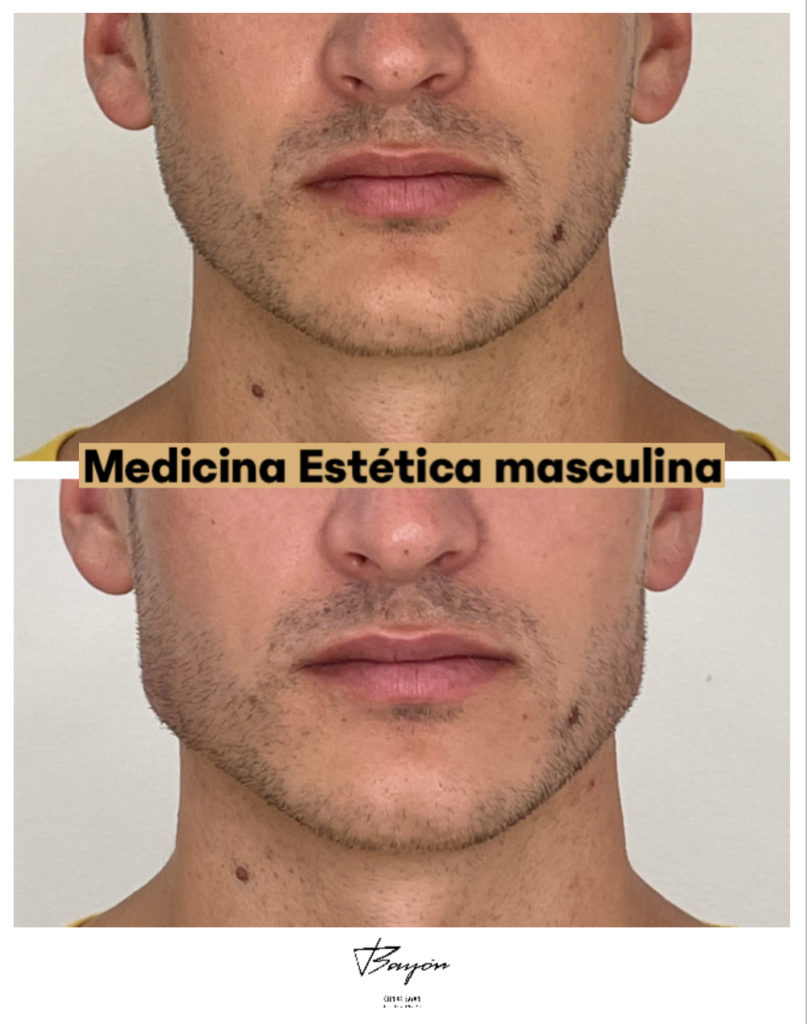 medicina estética masculina