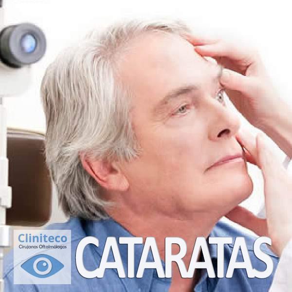 cataratas-clínica oftalmologica cliniteco