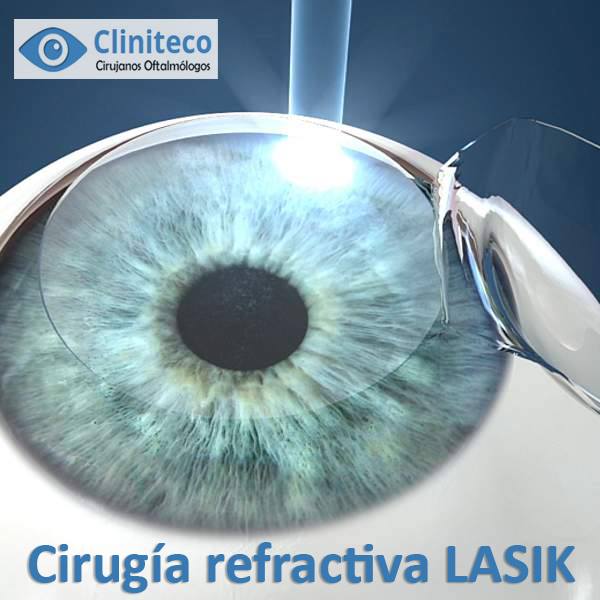 cirugía refrativa Lasik-clínica oftalmológica Cliniteco