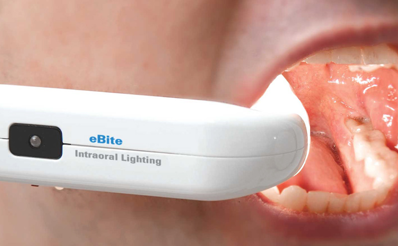 intraoral-lightning-1