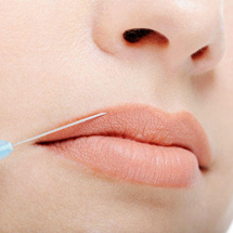 aumento-labios