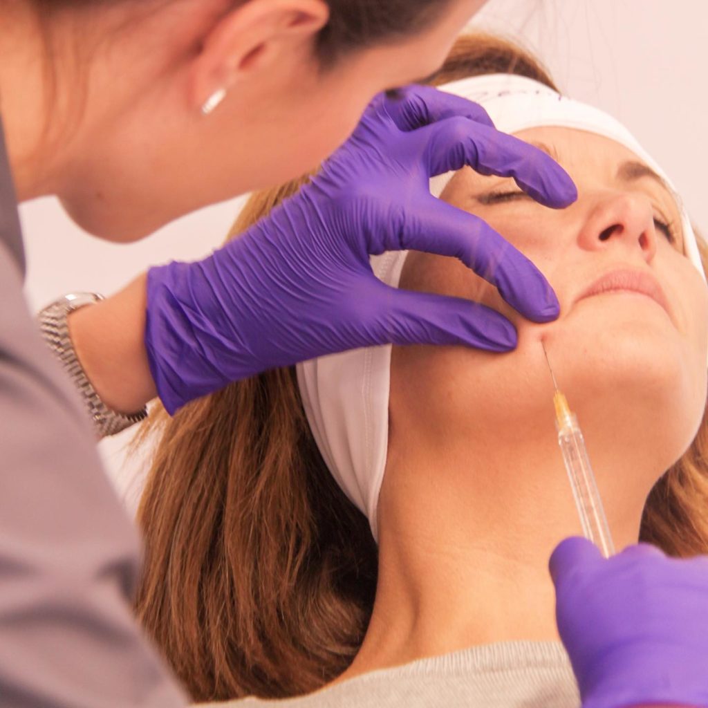 surco narsosiano-Dr. Mallent Cirugía estética en Valencia