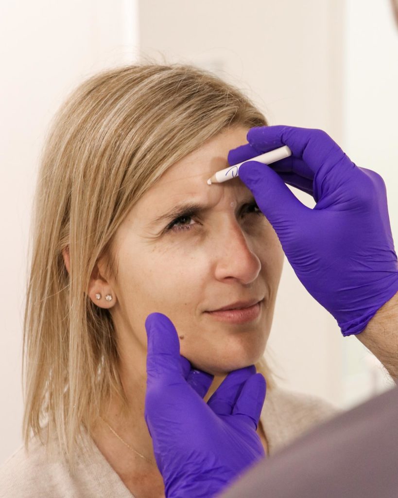 toxina botulínica-Dr.mallent-cirugía estética en Valencia