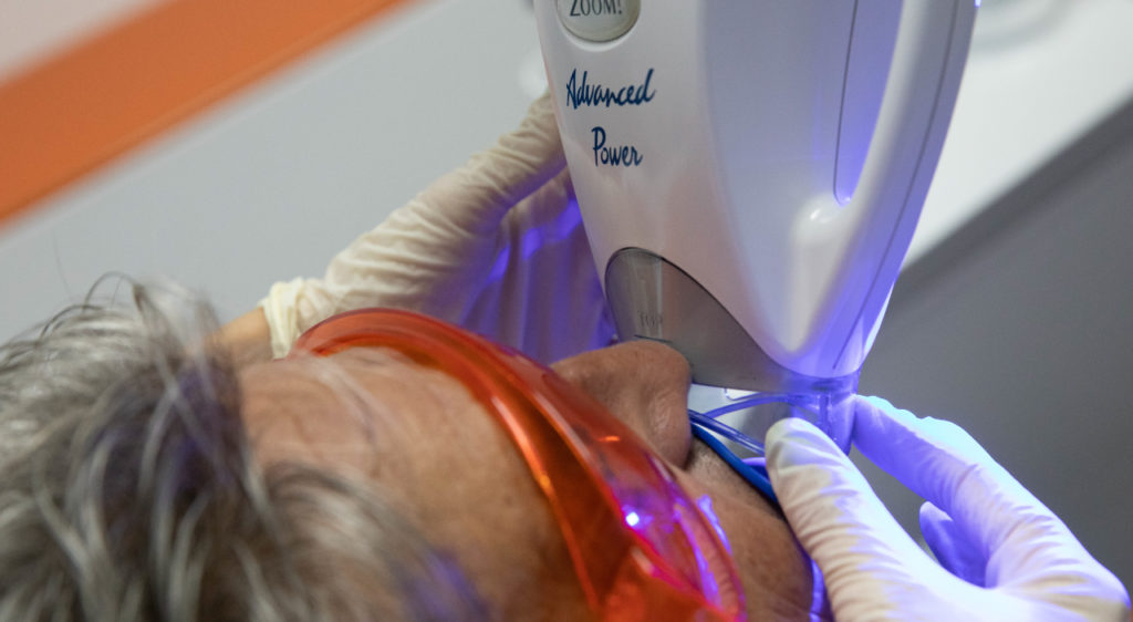 Blanqueamiento dental-Ced C Dentall