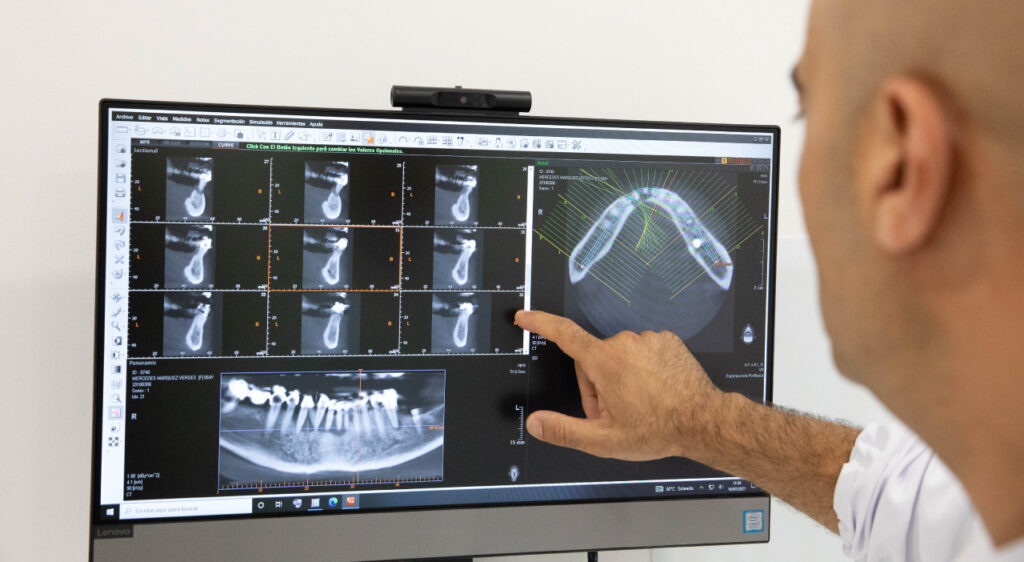 Implantes dentales-Ced C Dental
