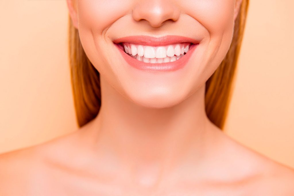 estética dental-clínica belodonte