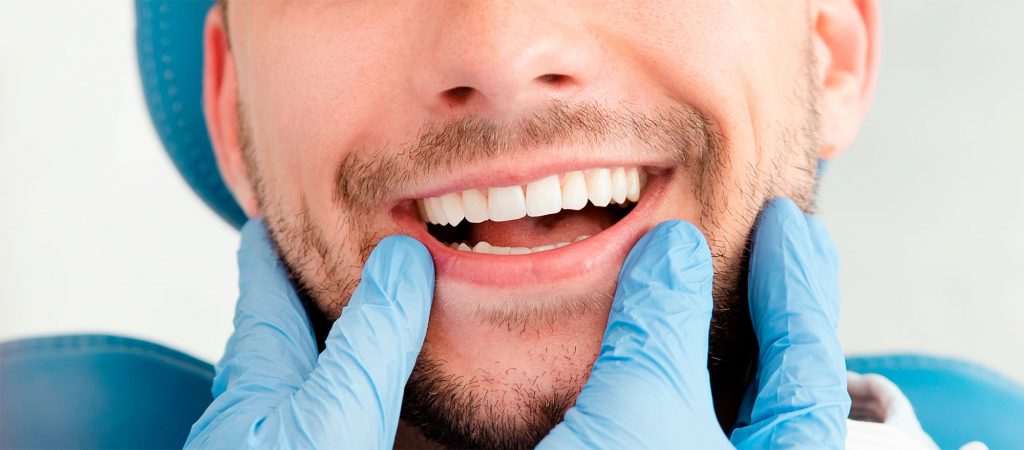 implantes dentales-clínica belodonte