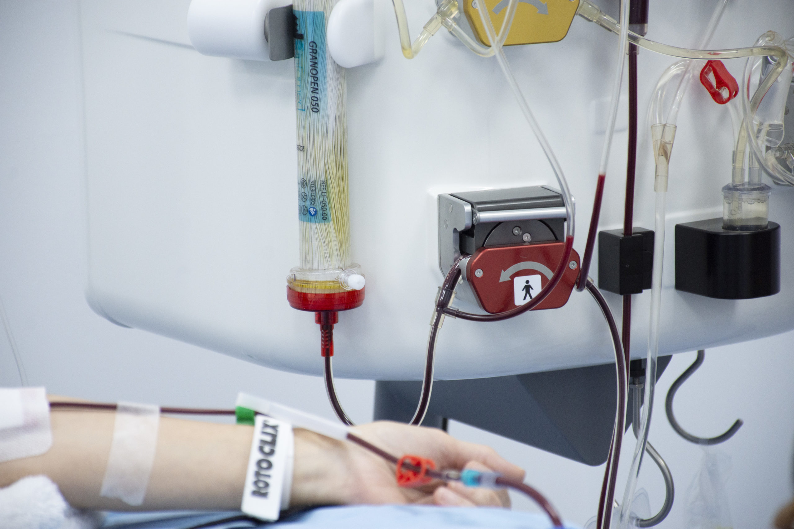 LA INUSpheresis®, técnica eficaz en el tratamiento de la toxicidad y la inflamación